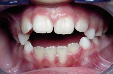 Nieuwe specialisatie